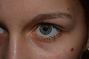 Офтальмолог объяснила, что делать при появлении синдрома сухого глаза