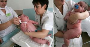 250-килограммовая женщина родила ребенка. Как думаете, сколько он весит?