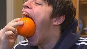 Самый большой рот в мире оказался у 18-летнего американца (фото)