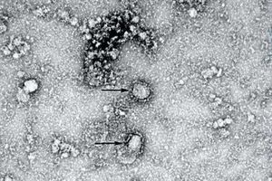 Американские ученые признали опасными антитела после COVID-19