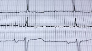 Кардиолог Серебрянский рассказал, какие продукты наносят вред сердцу