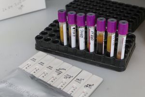 Удобно, но небезопасно: иммунолог Крючков рассказал, есть ли смысл в сертификатах по наличию антител