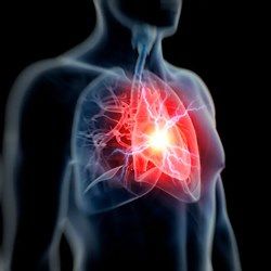Воспаление сердечной мышцы часто остается незамеченным: 6 признаков