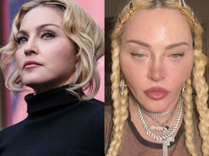 Какие процедуры превратили Мадонну в подобие гуманоида