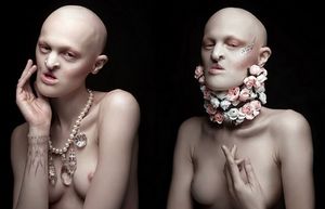 Мелани Гейдос – модель с генетическим расстройством, сломавшая стереотипы индустрии красоты