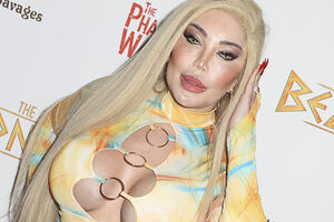 Мадонна обратилась за советом по пластике к трансгендеру с внешностью Барби