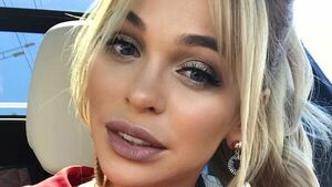 «Все болит!» Анна Хилькевич пожаловалась на проблемы со здоровьем