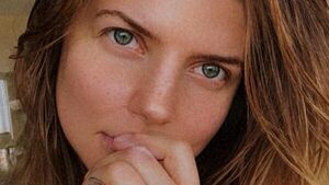 «Щелкает челюсть, шея забетонирована»: Настя Задорожная пожаловалась на здоровье