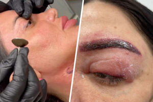 Звезда «Дома-2» Оксана Овсепян заявила, что косметолог специально изуродовала ее лицо