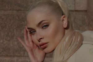 Подписчики раскритиковали внешность Алены Шишковой после операции на скулы