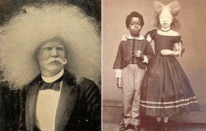 Истории альбиносов XIX века, попавших в объектив фотографа