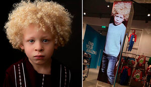 Как очаровательный мальчик-альбинос стал моделью и всеобщим любимцем