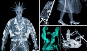 17 обалденных рентгеновских фотографий, на которых «внутренний мир» - не просто слова