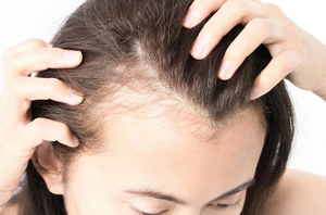 Наиболее распространённые причины выпадения волос