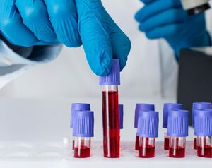 О чем может рассказать ваша группа крови — проверьте себя сейчас