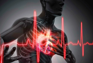 Инфаркт миокарда: как распознать и что делать