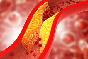 Статины и холестерин: польза, показания и возможные риски