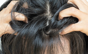 Почему чешется голова: 5 самых частых причин