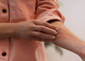 Кожный зуд: о чём на самом деле сигнализирует организм