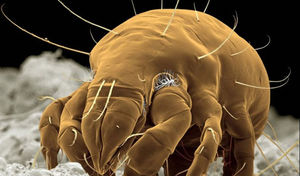 5 неприятных микроорганизмов, которые живут рядом с вами