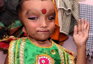 Жители индийской деревни поклоняются мальчику с деформированной головой как богу Ганеше