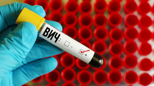 Ученые утверждают, что ВИЧ способен поражать не только Т-лимфоциты, как считалось ранее