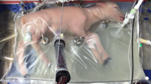 Учёные создали искусственную матку для недоношенных детей
