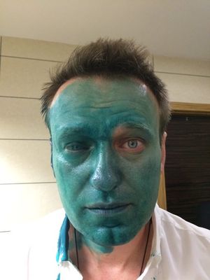 Навальному опять плеснули в лицо зеленкой