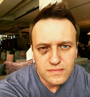 Навальному сделали операцию