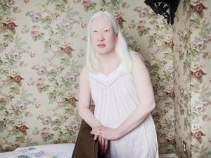Американский фотограф сняла проект с альбиносами