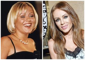 Российские знаменитости до и после пластики