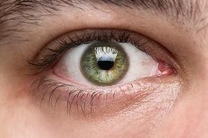 Новый патент Google: смарт-хрусталик глаза