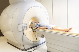 Алгоритм ИИ научился выявлять суицидальные наклонности по снимкам МРТ