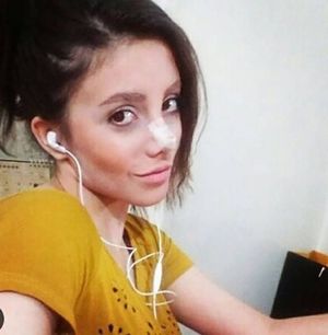 Иранка хотела превратиться в анджелину джоли, но стала похожа на зомби