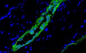 Учёные открыли новую разновидность стволовых клеток