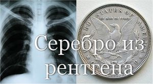 Оказывается, серебро производят и из рентген снимков