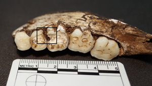 Сахар ни при чем: у наших древних предков были такие же проблемы с зубами