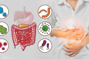 Дисбактериоз кишечника: причины, симптомы и способы восстановления баланса микрофлоры