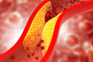 Статины и холестерин: польза, показания и возможные риски