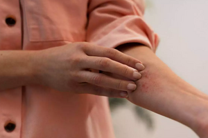 Кожный зуд: о чём на самом деле сигнализирует организм