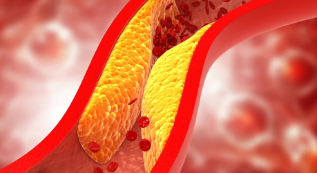 Статины и холестерин: польза, показания и возможные риски