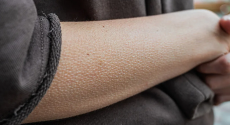 Почему появляются «мурашки» на коже и как от них избавиться