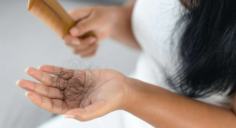 Выпадение волос: ошибки при мытье головы, о которых вы не задумываетесь