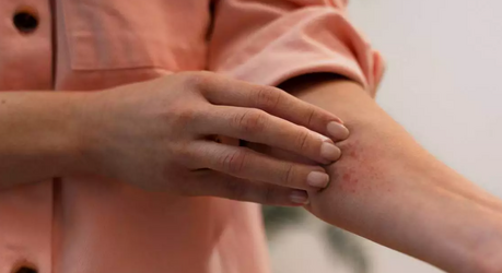 Кожный зуд: о чём на самом деле сигнализирует организм